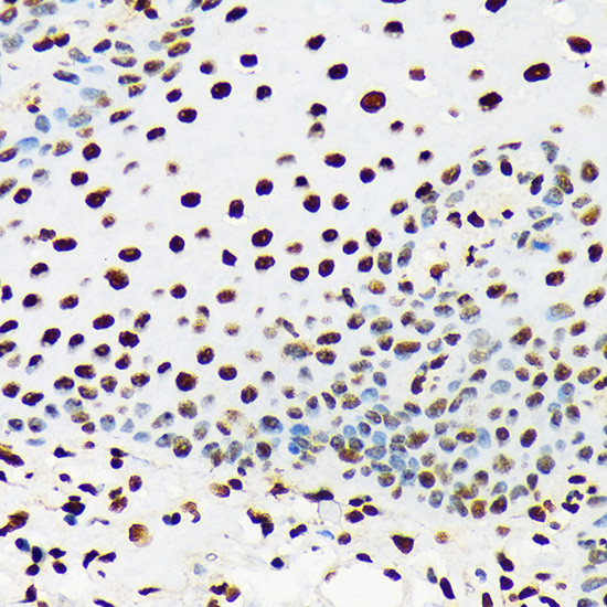 UAP56 Antibody in Immunohistochemistry (Paraffin) (IHC (P))