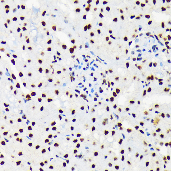 UAP56 Antibody in Immunohistochemistry (Paraffin) (IHC (P))