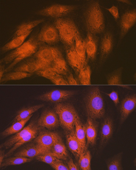 ACVRL1 Antibody in Immunocytochemistry (ICC/IF)