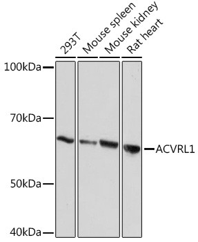 ACVRL1 Antibody in Western Blot (WB)