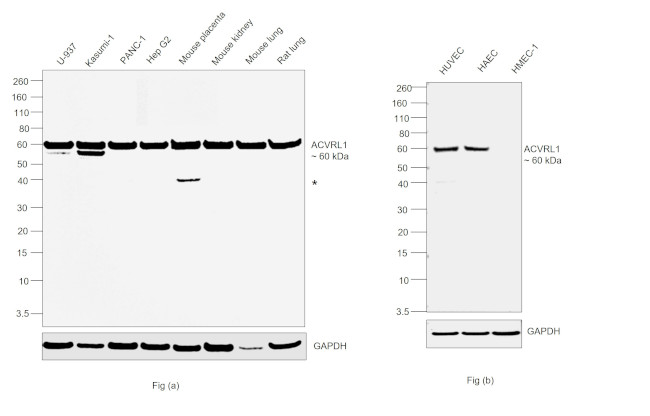 ACVRL1 Antibody in Western Blot (WB)