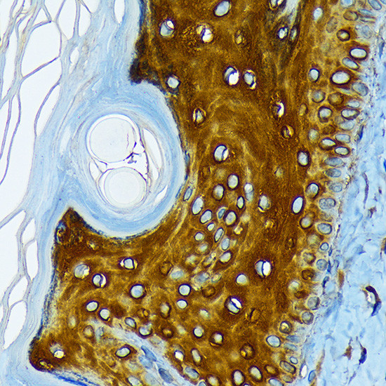 Cytokeratin 1 Antibody in Immunohistochemistry (Paraffin) (IHC (P))