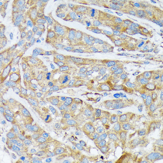 Cytokeratin 1 Antibody in Immunohistochemistry (Paraffin) (IHC (P))