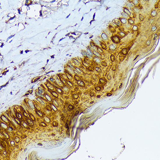 Cytokeratin 1 Antibody in Immunohistochemistry (Paraffin) (IHC (P))