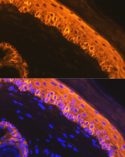 Cytokeratin 1 Antibody in Immunohistochemistry (Paraffin) (IHC (P))