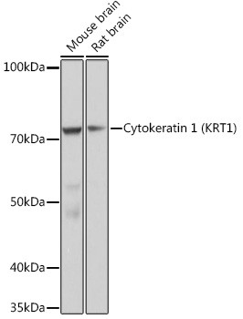 Cytokeratin 1 Antibody in Western Blot (WB)