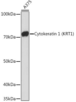 Cytokeratin 1 Antibody in Western Blot (WB)