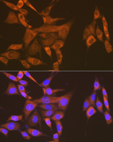 USP9X Antibody in Immunocytochemistry (ICC/IF)