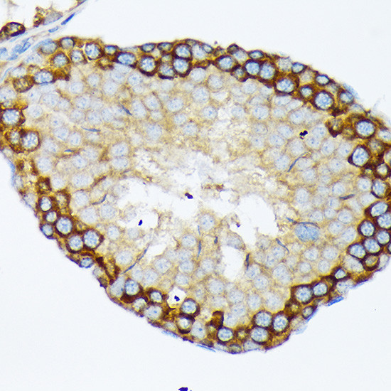 USP9X Antibody in Immunohistochemistry (Paraffin) (IHC (P))