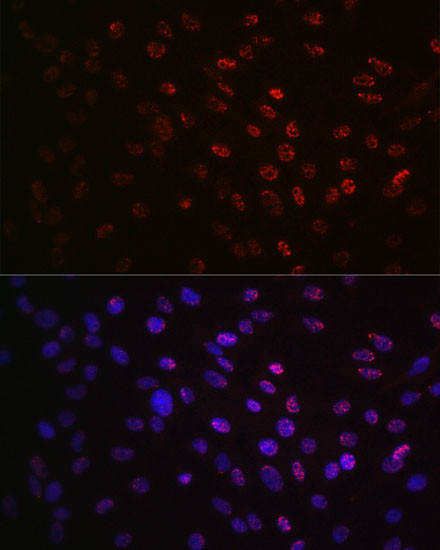 Phospho-p70 S6 Kinase (Thr421) Antibody in Immunocytochemistry (ICC/IF)