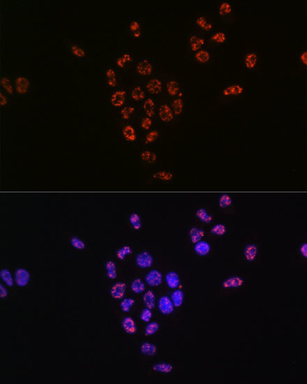 Phospho-p70 S6 Kinase (Thr421) Antibody in Immunocytochemistry (ICC/IF)