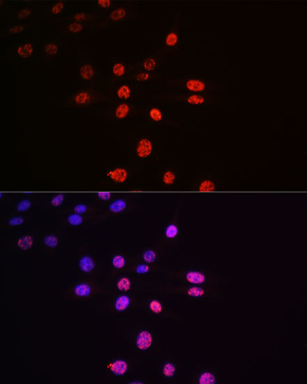 Phospho-p70 S6 Kinase (Thr421) Antibody in Immunocytochemistry (ICC/IF)