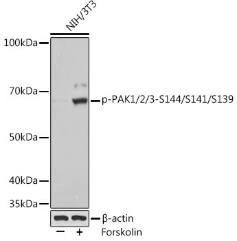 Phospho-PAK1/2/3 (Ser144) Antibody in Western Blot (WB)