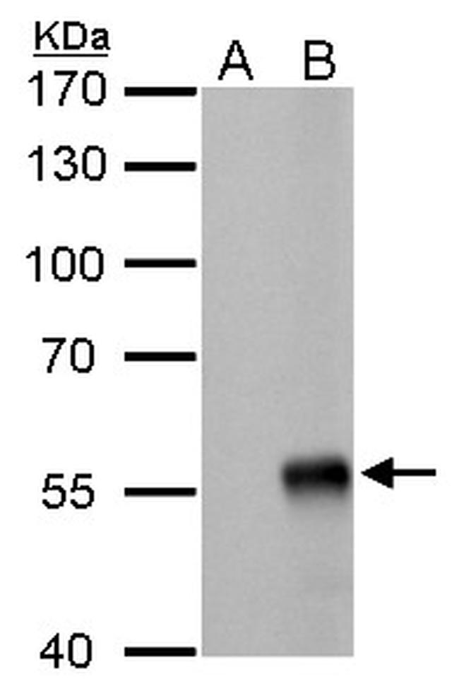 Influenza A NP Antibody in Western Blot (WB)