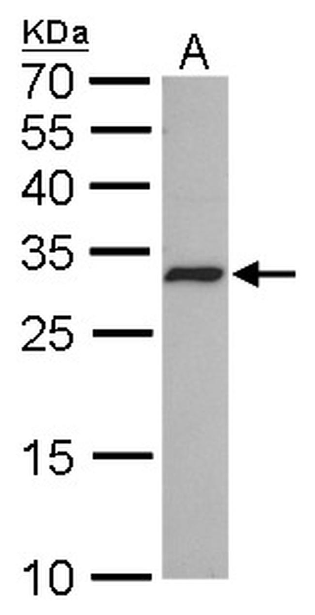 CDK4 Antibody in Western Blot (WB)