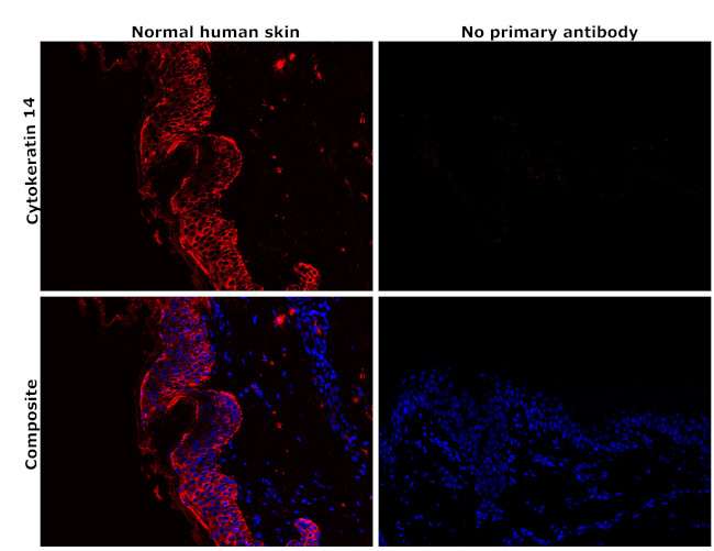 Cytokeratin 14 Antibody in Immunohistochemistry (Paraffin) (IHC (P))