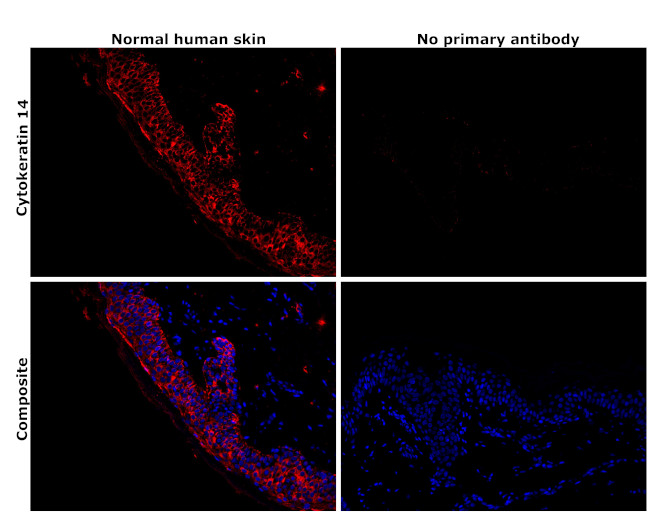 Cytokeratin 14 Antibody in Immunohistochemistry (Paraffin) (IHC (P))