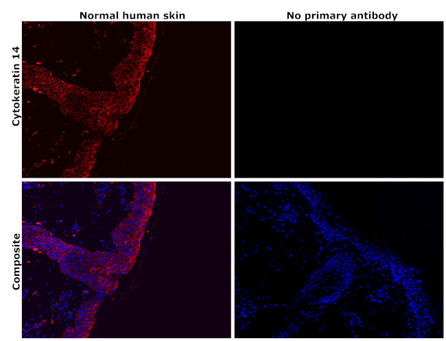 Cytokeratin 14 Antibody in Immunohistochemistry (Paraffin) (IHC (P))