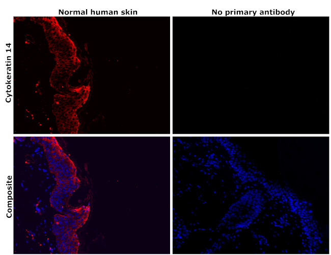 Cytokeratin 14 Antibody in Immunohistochemistry (Paraffin) (IHC (P))