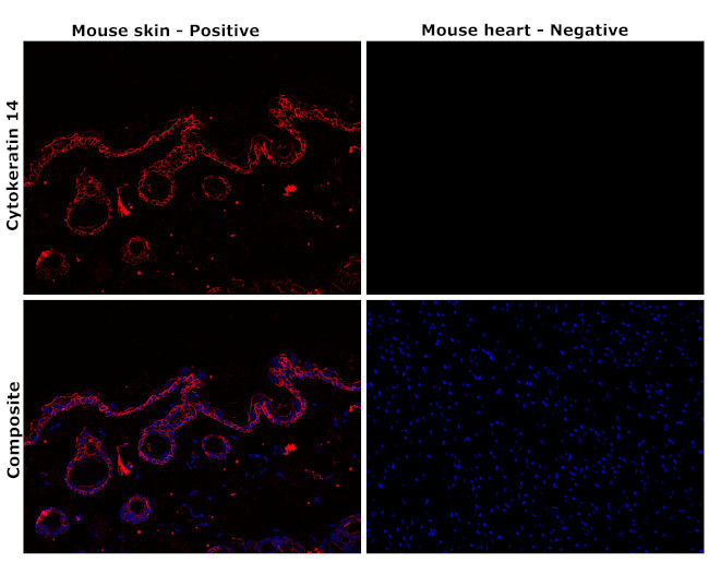 Cytokeratin 14 Antibody in Immunohistochemistry (Paraffin) (IHC (P))