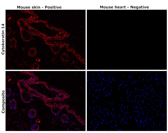 Cytokeratin 14 Antibody in Immunohistochemistry (Paraffin) (IHC (P))