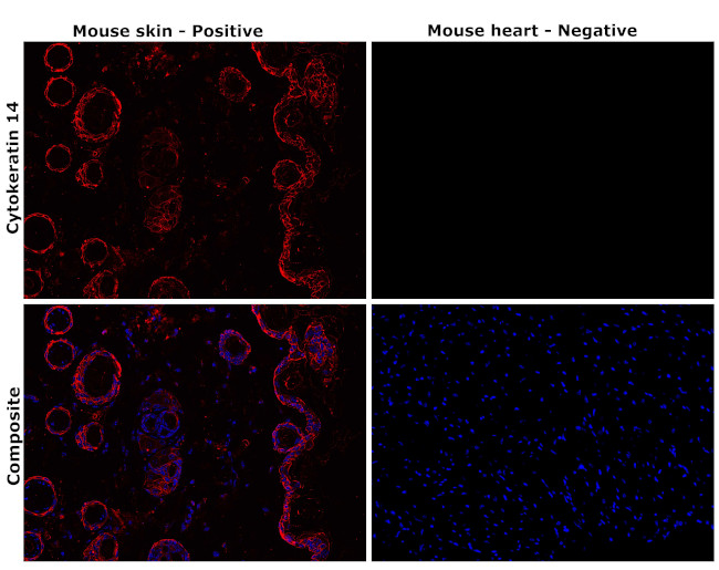 Cytokeratin 14 Antibody in Immunohistochemistry (Paraffin) (IHC (P))