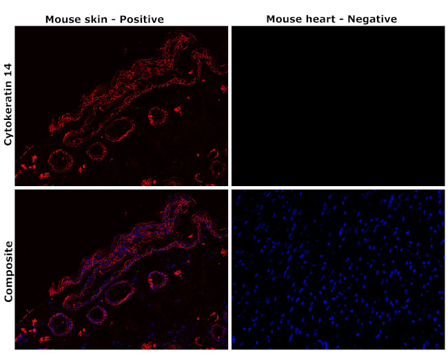 Cytokeratin 14 Antibody