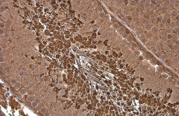 PGK1 Antibody in Immunohistochemistry (Paraffin) (IHC (P))