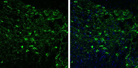 Tyrosine Hydroxylase Antibody in Immunohistochemistry (Paraffin) (IHC (P))