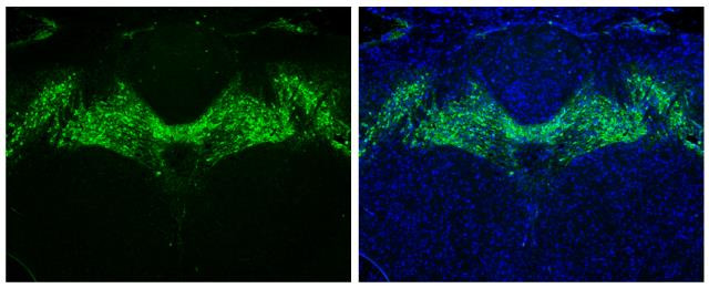 Tyrosine Hydroxylase Antibody in Immunohistochemistry (Paraffin) (IHC (P))