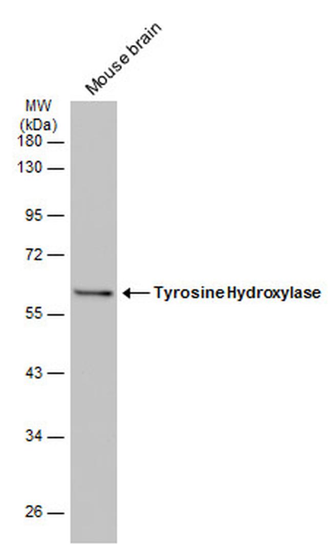 Tyrosine Hydroxylase Antibody in Western Blot (WB)