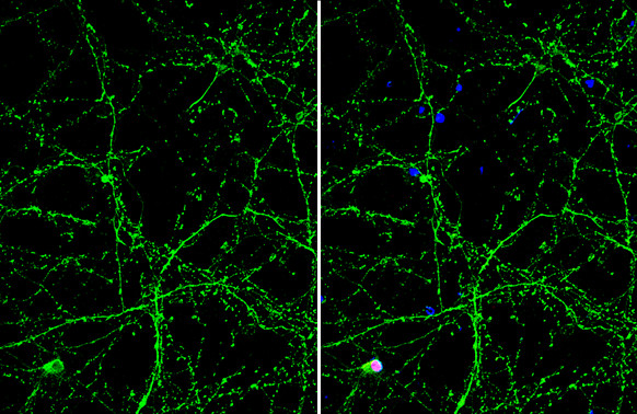 OTUB1 Antibody in Immunocytochemistry (ICC/IF)