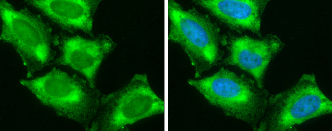 SH3GL1 Antibody in Immunocytochemistry (ICC/IF)