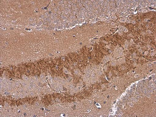 SH3GL1 Antibody in Immunohistochemistry (Paraffin) (IHC (P))