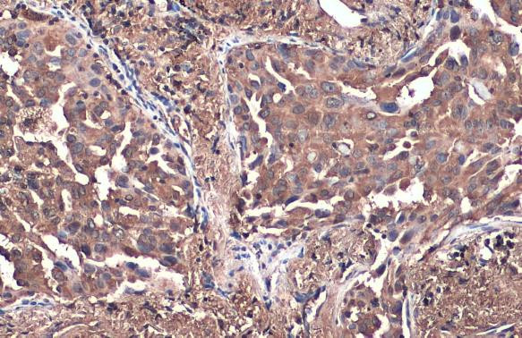 PKM Antibody in Immunohistochemistry (Paraffin) (IHC (P))