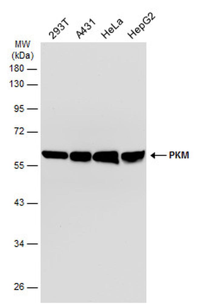 PKM Antibody in Western Blot (WB)