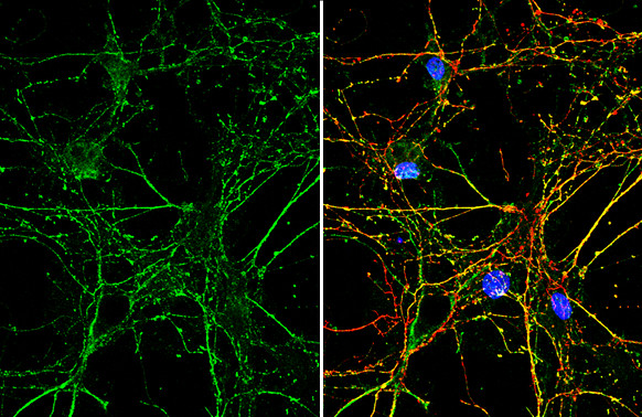 PARK7 Antibody in Immunocytochemistry (ICC/IF)