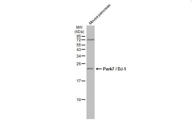 PARK7 Antibody in Western Blot (WB)