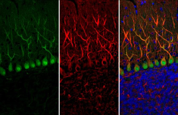 Calbindin Antibody in Immunohistochemistry (Paraffin) (IHC (P))