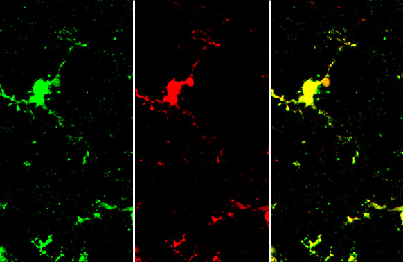 IBA1 Antibody in Immunohistochemistry (Frozen) (IHC (F))