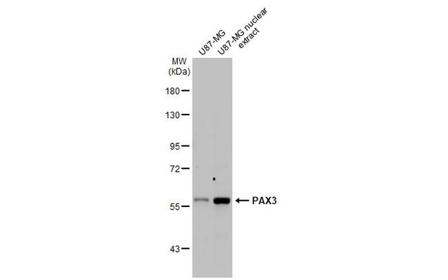 PAX3 Antibody in Western Blot (WB)