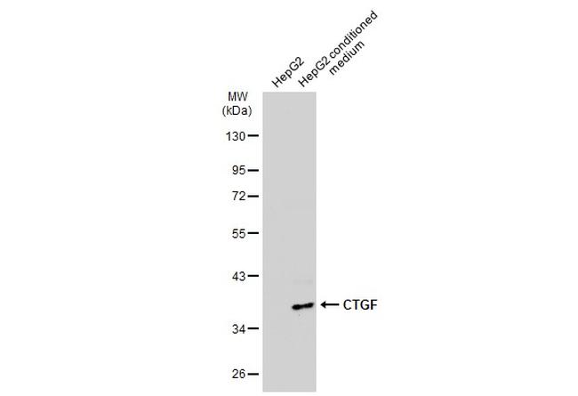 CTGF Antibody in Western Blot (WB)