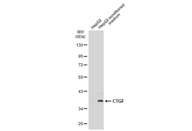 CTGF Antibody in Western Blot (WB)