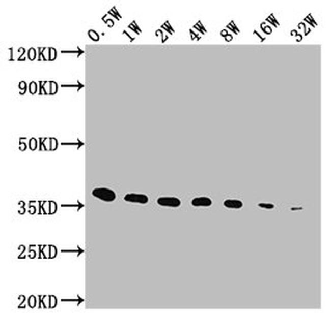 E Tag Antibody in Western Blot (WB)