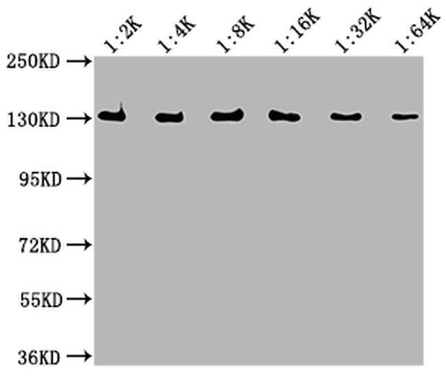 E. coli GLB1 Antibody in Western Blot (WB)