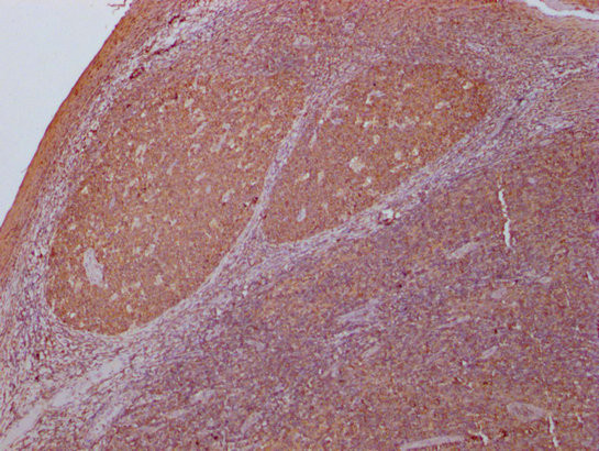 PKM Antibody in Immunohistochemistry (Paraffin) (IHC (P))