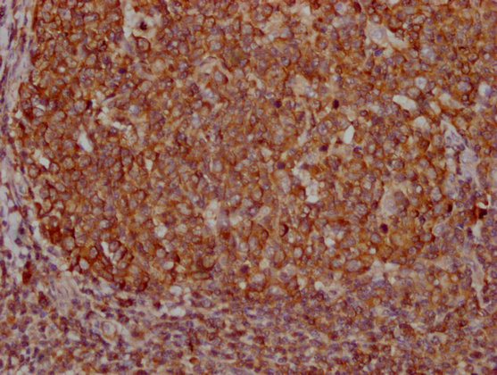 PKM Antibody in Immunohistochemistry (Paraffin) (IHC (P))