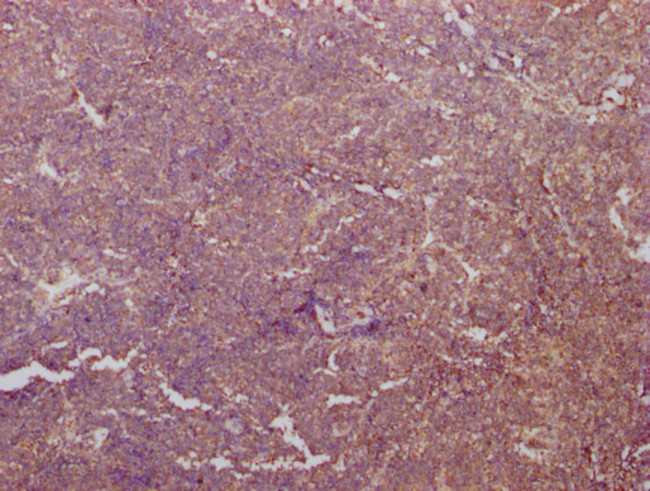 PKM Antibody in Immunohistochemistry (Paraffin) (IHC (P))