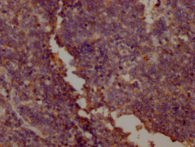 PKM Antibody in Immunohistochemistry (Paraffin) (IHC (P))