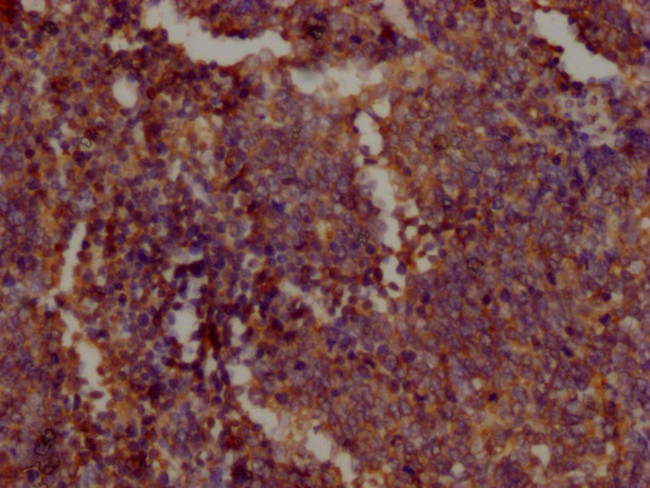 PKM Antibody in Immunohistochemistry (Paraffin) (IHC (P))